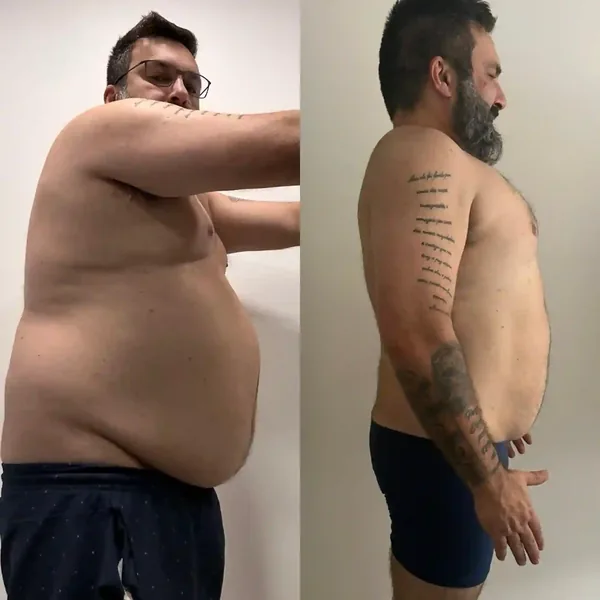 Transformação 5